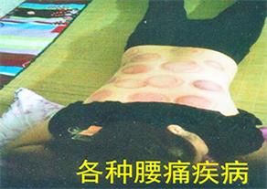 153、各種腰痛疾病.jpg